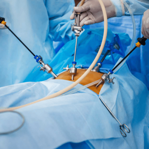 Advanced laparoscopy in Gynae Oncology Cadaveric Course (10/23)